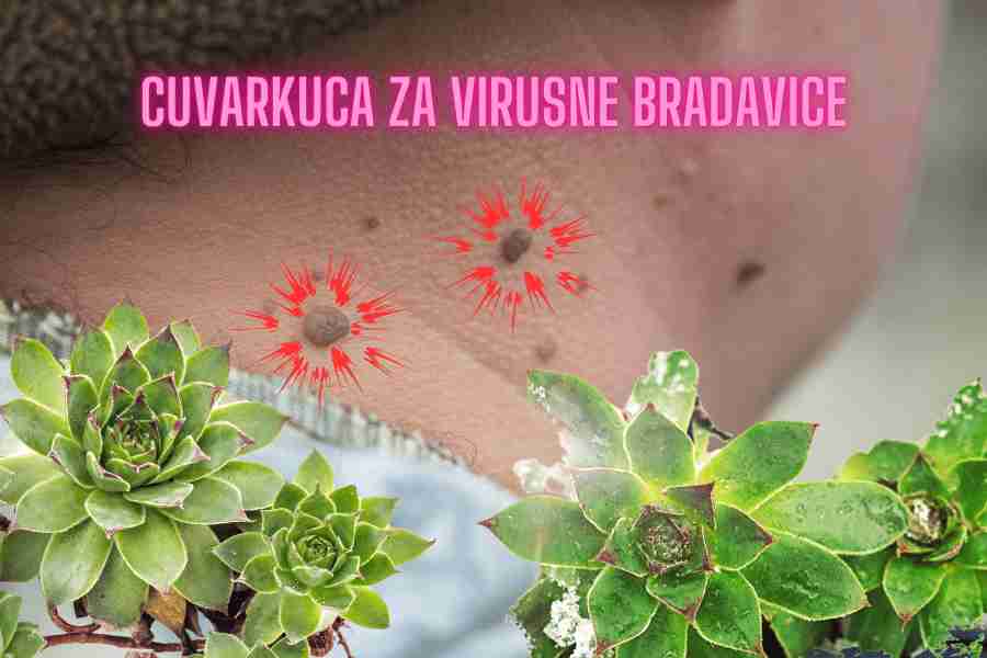 ČUVARKUĆA ZA VIRUSNE BRADAVICE